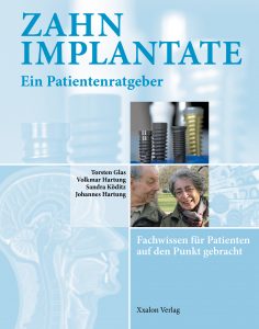 Zahnimplantate - Ein Patientenratgeber